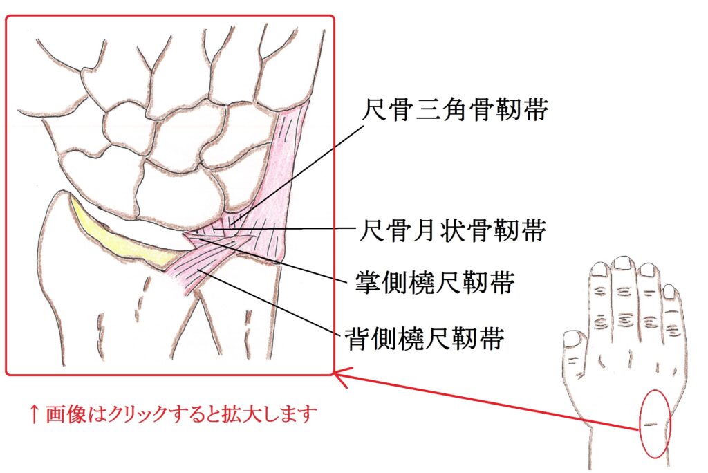TFCC（三角線維軟骨複合体）損傷