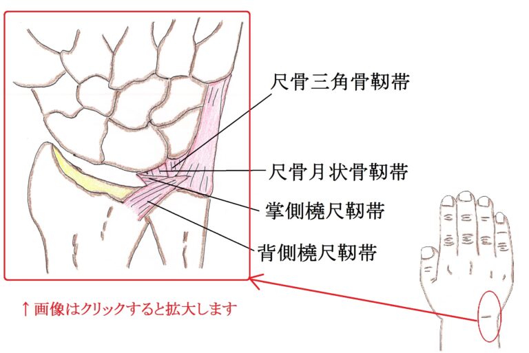 TFCC（三角線維軟骨複合体）損傷
