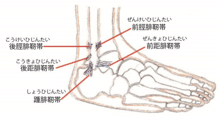 足首の捻挫（足関節捻挫）