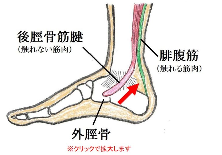 有痛性外脛骨（外脛骨障害）