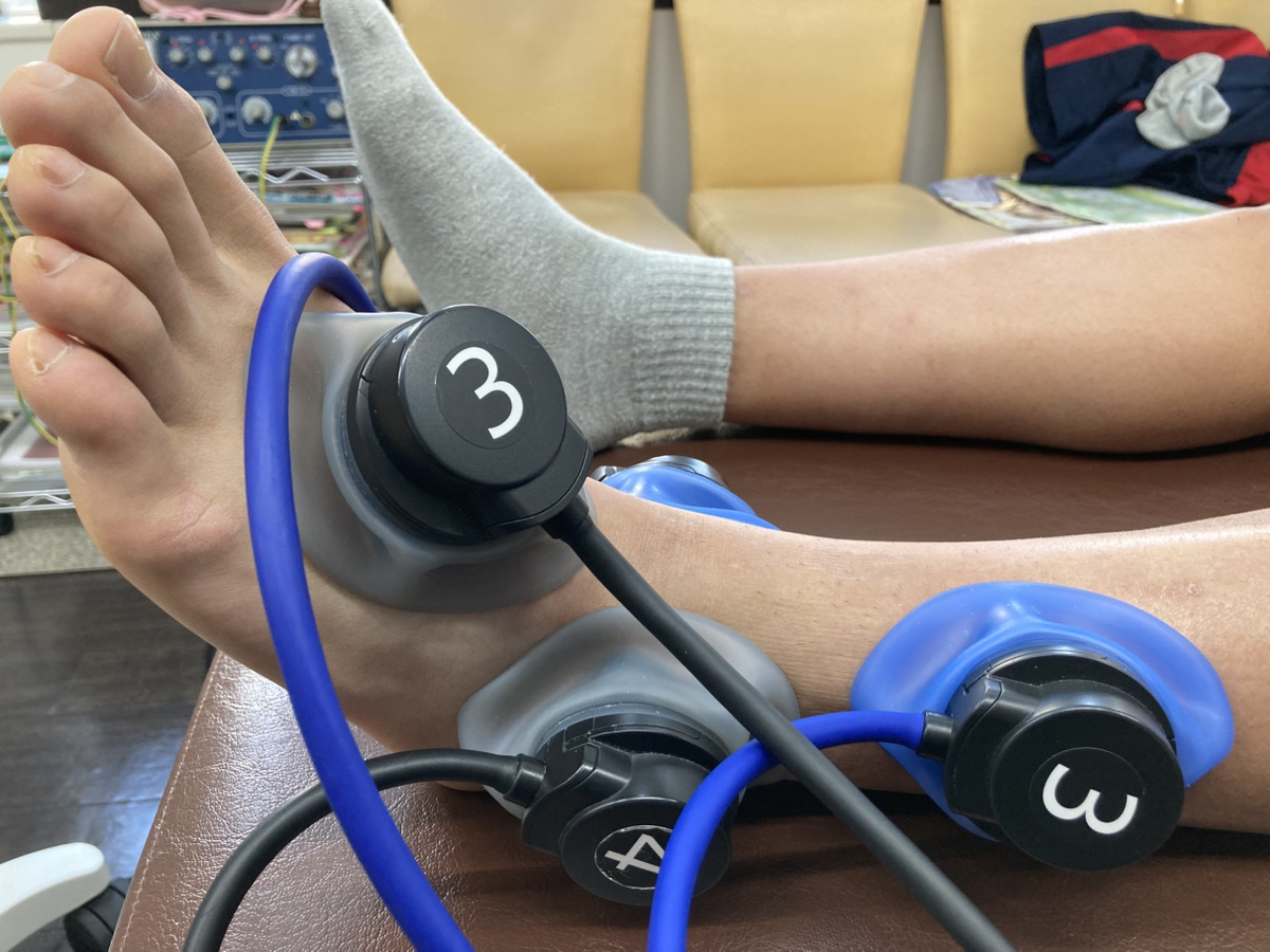 足関節周辺に電気療法を行っている様子