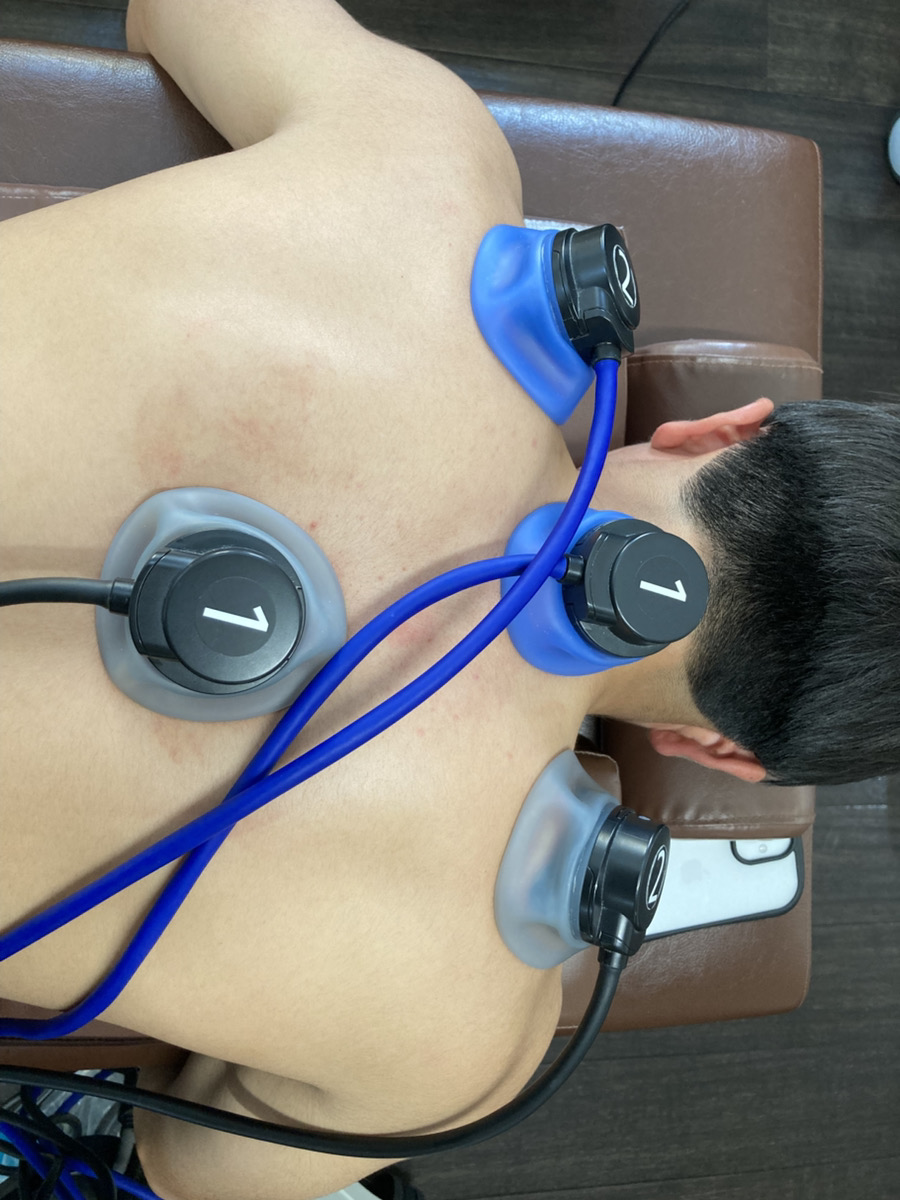 背部に電気療法を行っている様子