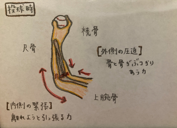 野球肘