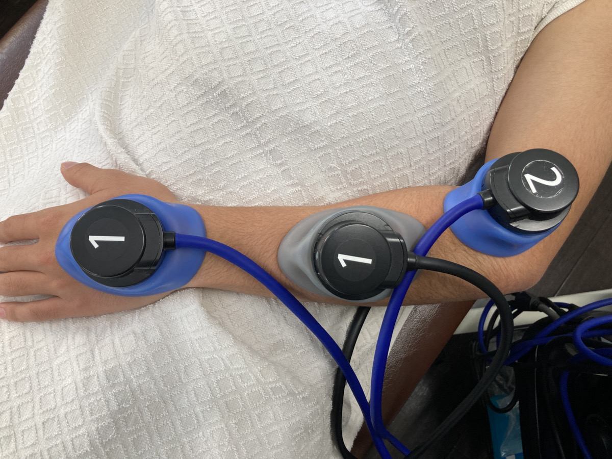 肘に電気療法を行っている様子