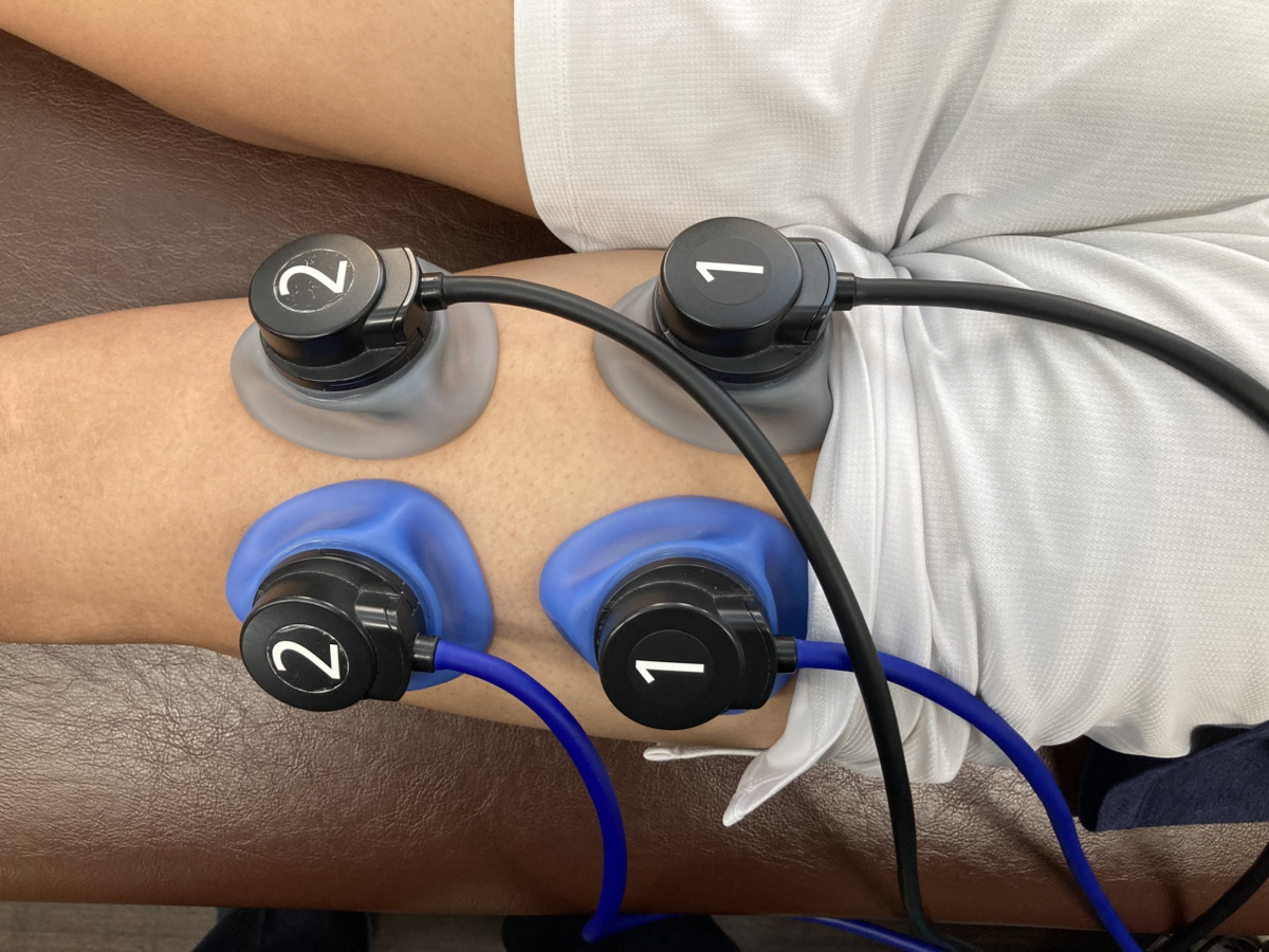 ハムストリングスに電気療法を行っている様子