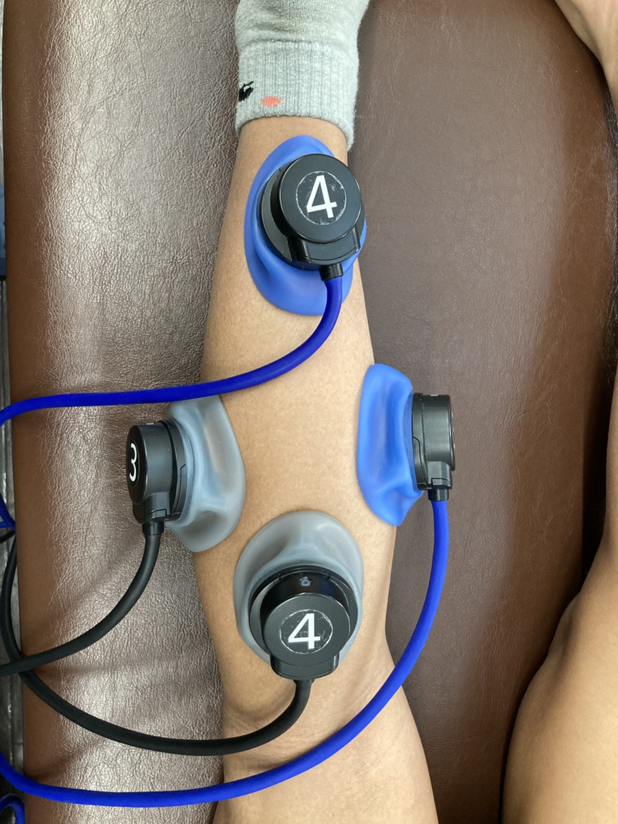 下腿部に電気療法を行っている様子