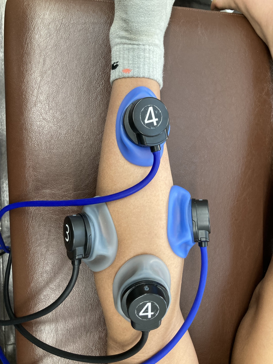 下腿部に電気療法を行っている様子