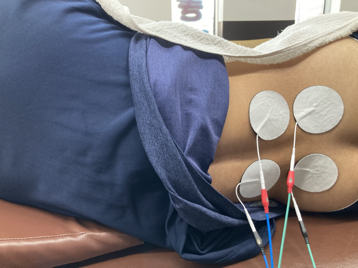 腰部に電気療法を行っている様子