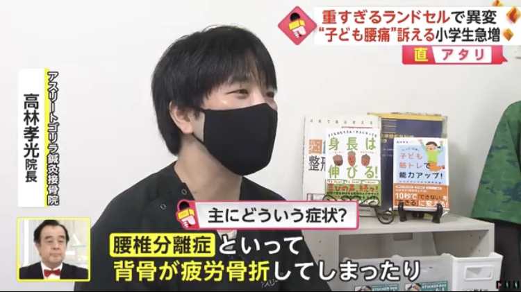 FNN系列『Live News イット!』で腰椎分離症について解説する様子