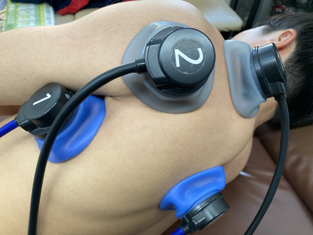 肩に電気療法を行っている様子