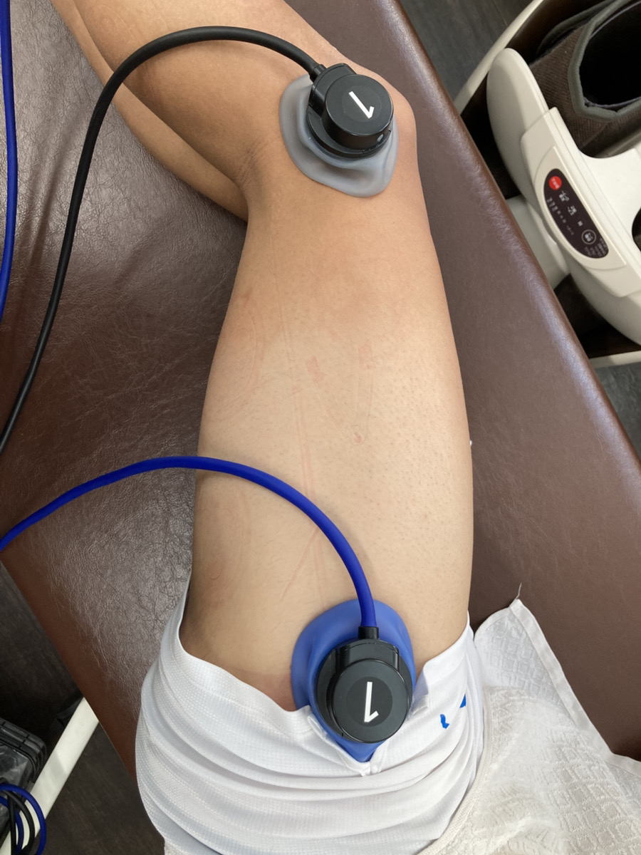 大腿部に電気療法を行っている様子