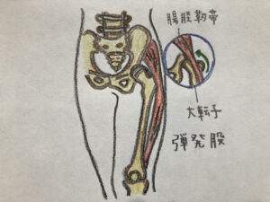 弾発股（ばね股）