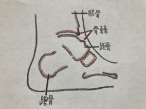 足根洞症候群