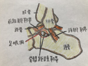 足根洞症候群